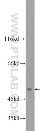 ZFP2 Antibody in Western Blot (WB)