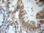 FGFBP3 Antibody in Immunohistochemistry (Paraffin) (IHC (P))