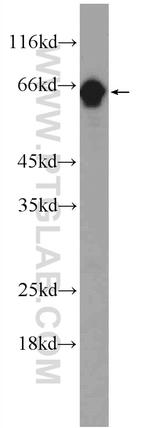 FGFBP3 Antibody in Western Blot (WB)