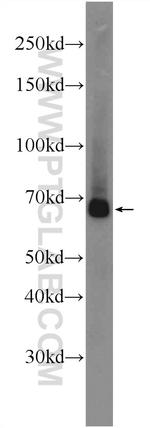 FGFBP3 Antibody in Western Blot (WB)