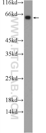 FGFBP3 Antibody in Western Blot (WB)