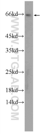 FGFBP3 Antibody in Western Blot (WB)