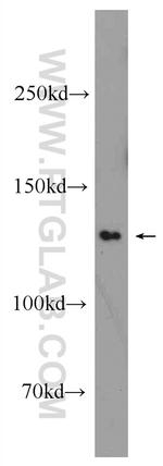 EFTUD1 Antibody in Western Blot (WB)