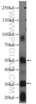 ODF1 Antibody in Western Blot (WB)