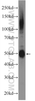 ODF1 Antibody in Western Blot (WB)