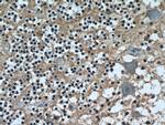 HYDIN Antibody in Immunohistochemistry (Paraffin) (IHC (P))