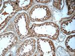 HYDIN Antibody in Immunohistochemistry (Paraffin) (IHC (P))