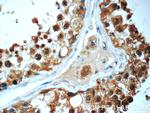 HYDIN Antibody in Immunohistochemistry (Paraffin) (IHC (P))