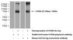 HYDIN Antibody in Western Blot (WB)