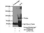 ACE Antibody in Immunoprecipitation (IP)