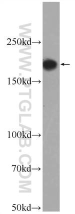 ACE Antibody in Western Blot (WB)