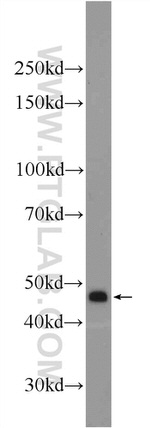 ZDHHC13 Antibody in Western Blot (WB)