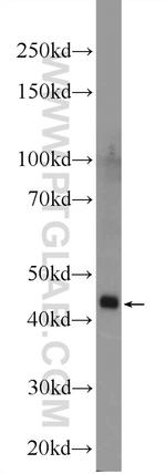 ZDHHC13 Antibody in Western Blot (WB)