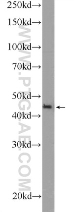 ZDHHC13 Antibody in Western Blot (WB)