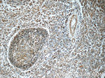 LRMP Antibody in Immunohistochemistry (Paraffin) (IHC (P))