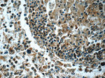 LRMP Antibody in Immunohistochemistry (Paraffin) (IHC (P))