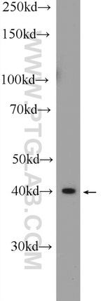 IKZF5 Antibody in Western Blot (WB)