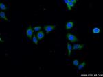 PIK3C2B Antibody in Immunocytochemistry (ICC/IF)