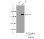 PIK3C2B Antibody in Immunoprecipitation (IP)