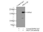 PIK3C2B Antibody in Immunoprecipitation (IP)