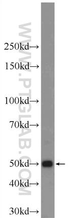 KRT12 Antibody in Western Blot (WB)