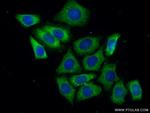 GIGYF2 Antibody in Immunocytochemistry (ICC/IF)