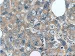 GIGYF2 Antibody in Immunohistochemistry (Paraffin) (IHC (P))