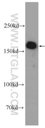 GIGYF2 Antibody in Western Blot (WB)