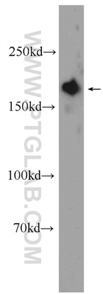 GIGYF2 Antibody in Western Blot (WB)