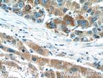 DMGDH Antibody in Immunohistochemistry (Paraffin) (IHC (P))