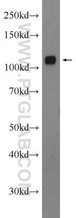 GLDC Antibody in Western Blot (WB)