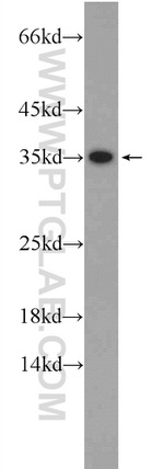 IDNK Antibody in Western Blot (WB)