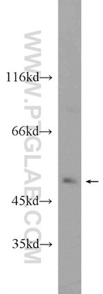 SETD7 Antibody in Western Blot (WB)