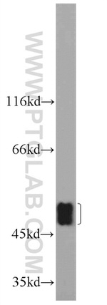 SETD7 Antibody in Western Blot (WB)