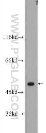 SETD7 Antibody in Western Blot (WB)