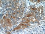 VISTA Antibody in Immunohistochemistry (Paraffin) (IHC (P))