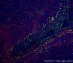 VISTA Antibody in Immunohistochemistry (PFA fixed) (IHC (PFA))