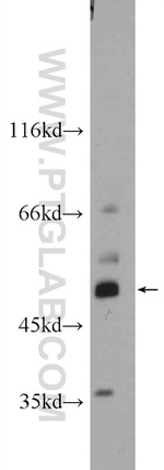 GAL3ST3 Antibody in Western Blot (WB)