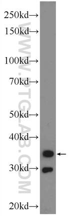 Calponin 1 Antibody in Western Blot (WB)