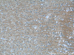 NMU Antibody in Immunohistochemistry (Paraffin) (IHC (P))