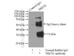 TREX1 Antibody in Immunoprecipitation (IP)