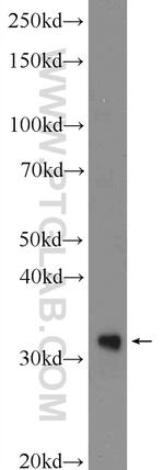 TREX1 Antibody in Western Blot (WB)