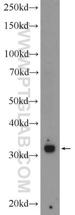 TREX1 Antibody in Western Blot (WB)