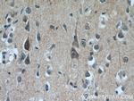 PPP2R3C Antibody in Immunohistochemistry (Paraffin) (IHC (P))