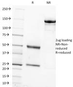 FSH-beta (Follicle Stimulating Hormone-beta) Antibody in SDS-PAGE (SDS-PAGE)