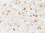 FSH-beta (Follicle Stimulating Hormone-beta) Antibody in Immunohistochemistry (Paraffin) (IHC (P))