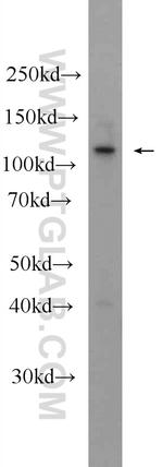 KIAA1217 Antibody in Western Blot (WB)