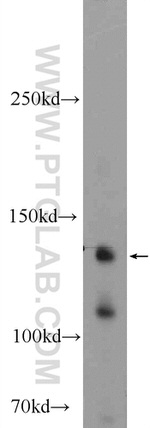 KIAA1217 Antibody in Western Blot (WB)