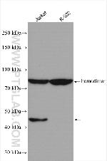 PLEKHO1 Antibody in Western Blot (WB)