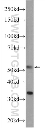 PLEKHO1 Antibody in Western Blot (WB)